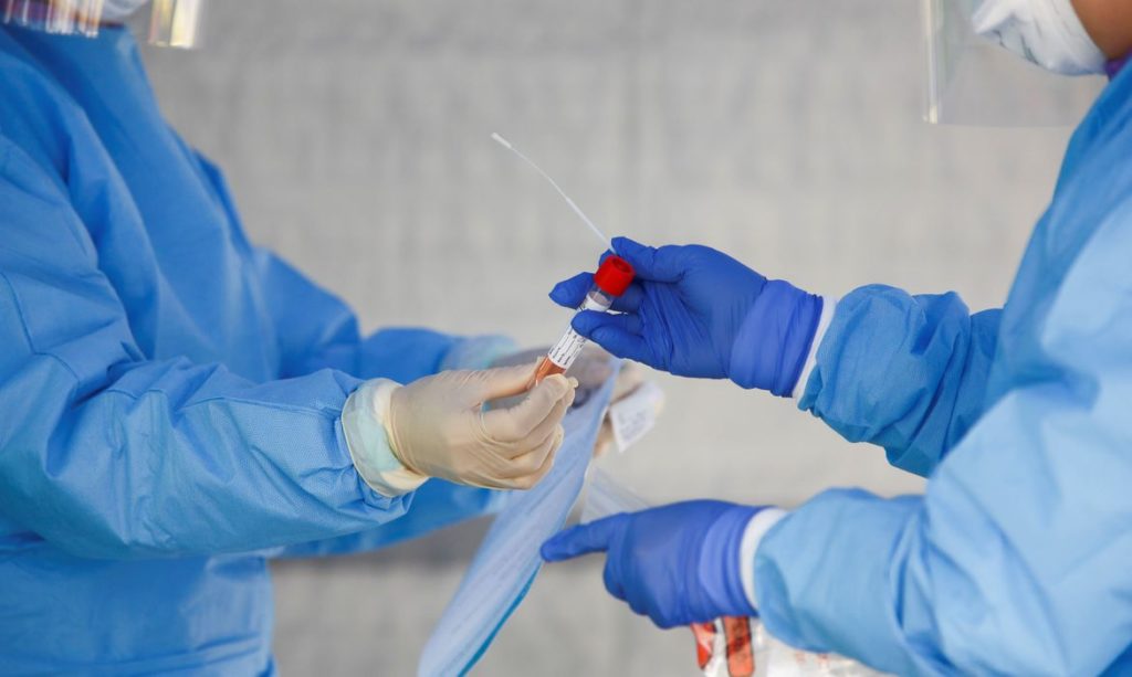 teste coronavirus