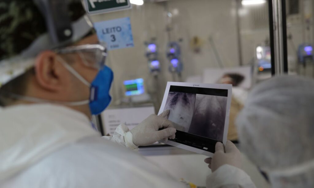 radiografia de torax coronaviruscovid  hospital sao paulo