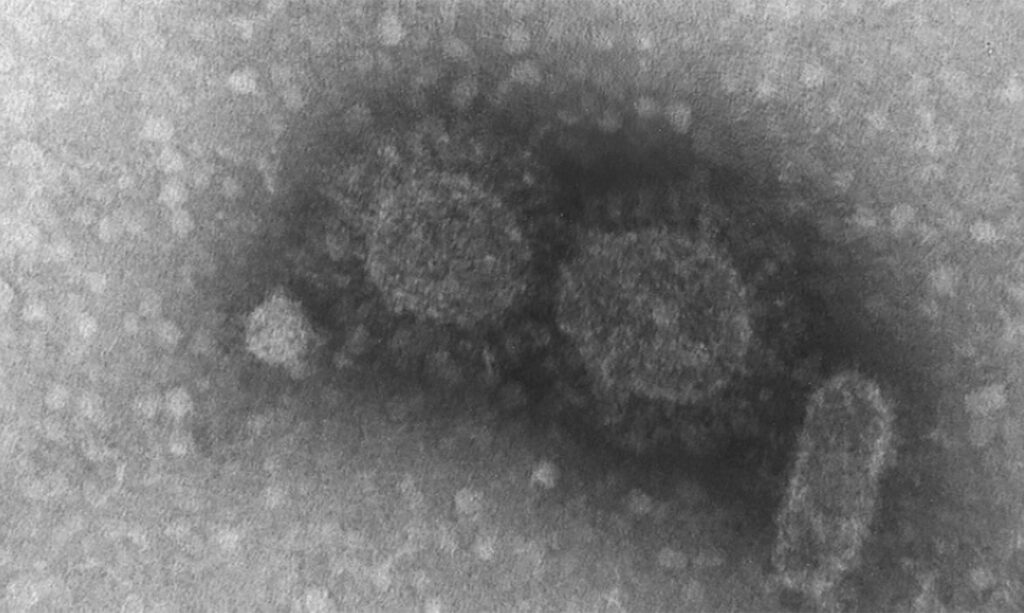 sequenciamento genetico do coronavirus instituto adolfo lutz